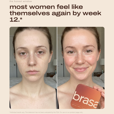 brasa gentle iron strips