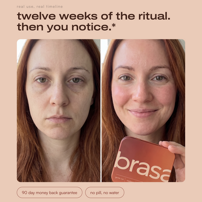 brasa gentle iron strips